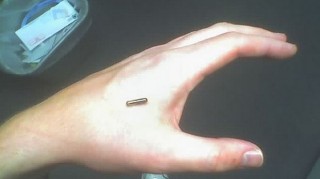 implantes de chips